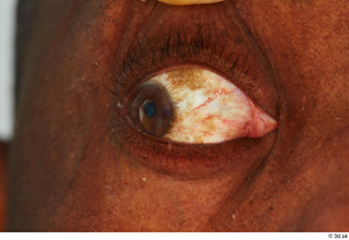 HD Eyes Quintrell Wheeler eye eyelash iris pupil skin texture…